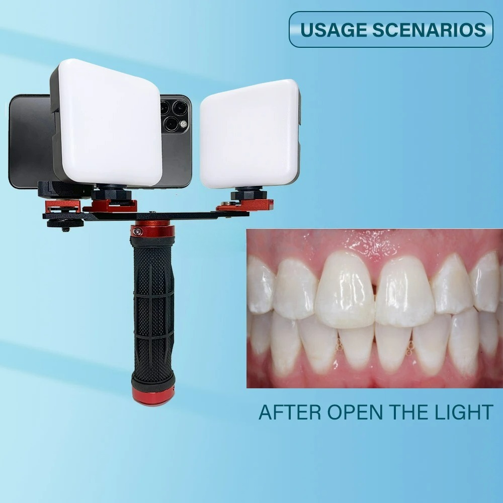 Luz de Fotografia Odontológica - Photography Lighting Accessories avaliação e preço